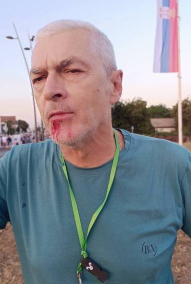 СНС туче, полиција гледа: Посланик Булатовић пред полицијом цепао „Труби за студенте“, у Ветернику има повређених&hellip;